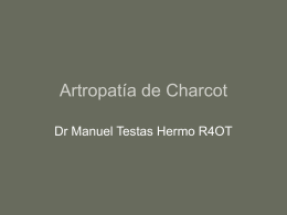 Artropatía de Charcot