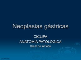 Neoplasias gástricas - Cátedra de Anatomía Patológica