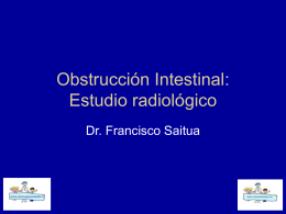 Obstrucción Intestinal: Estudio radiológico