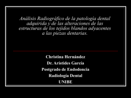 Análisis Radiográfico de la patología dental adquirida y de las