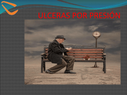 ULCERAS POR PRESIÓN - Over-blog