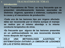 TRAUMATISMOS DE TÓRAX