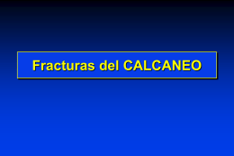 04- Fracturas del Calcáneo - lerat
