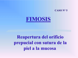 FIMOSIS