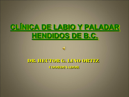 CLINICA DE LABIO Y PALADAR HENDIDOS.