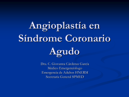 Angioplastía en Síndrome Coronario Agudo (PPTminimizer)
