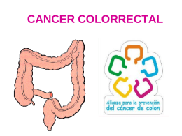 cancer colorrectal