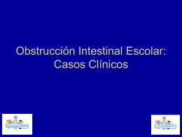 Obstrucción Intestinal Escolar - Bienvenidos a Mi cirujano Infantil. cl