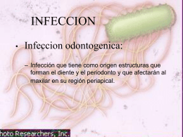 Infecciones odontogénicas