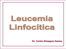 Leucemia Linfocítica - Departamento de Medicina Interna.