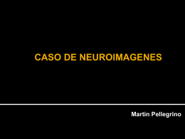 CASO VIERNES - Centro de Diagnóstico Dr. Enrique Rossi
