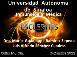 Escleritis