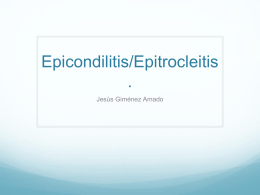 Epicondilitis/Epitrocleitis.