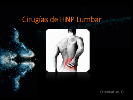 Cirugías de HNP Lumbar