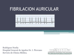 fibrilacion auricular 1