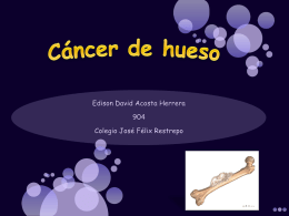 Cáncer de hueso