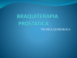 braquiterapia prostatica