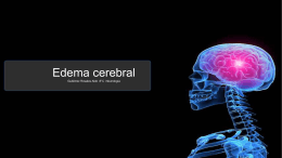 Edema cerebral - Carpe Diem – Cogito ergo sum