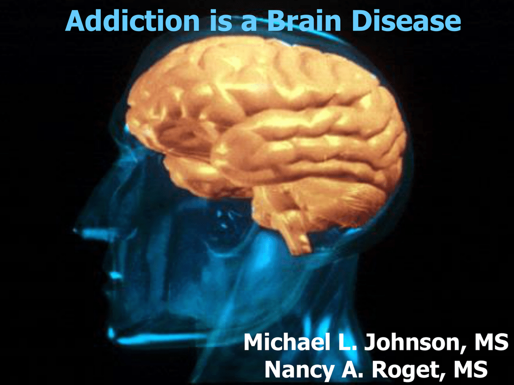 Brain disease. Мозг ms3. Мозг болезнь шапочка кардинала. Addicted Brain.