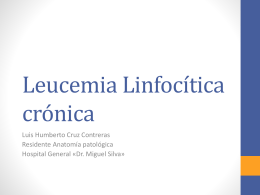 Leucemia Linfocítica crónica