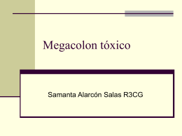 Megacolon tóxico
