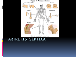 Artritis séptica