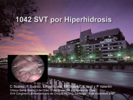Simpatectomía por video en hiperhidrosis de