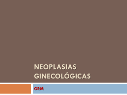 Neoplasias Ginecológicas