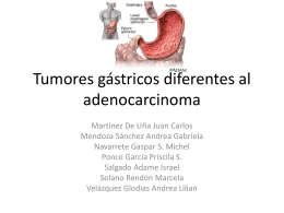 Tumores gástricos diferentes al adenocarcinoma