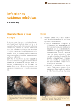 Infecciones cutáneas micóticas - Asociación Española de Pediatría
