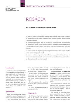 ROSÁCEA - Actualizaciones Terapeuticas Dermatologicas y Esteticas