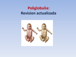 Poliglobulia