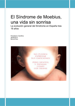 El Síndrome de Moebius, una vida sin sonrisa