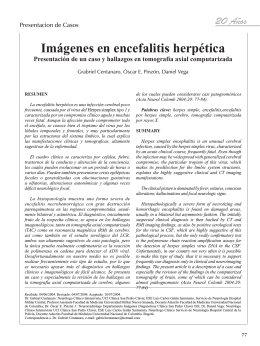 Imágenes en encefalitis herpética