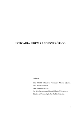Urticaria y Edema Angioneurótico