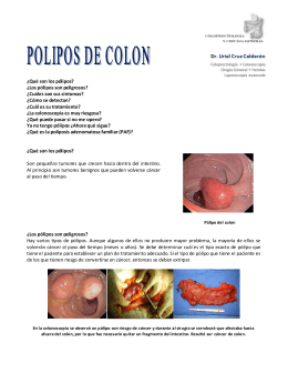 Pólipos de colon - Coloproctología (Enfermedades de Colon, Recto