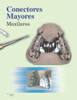 Conectores mayores maxilares