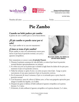 Clubfoot #1160
