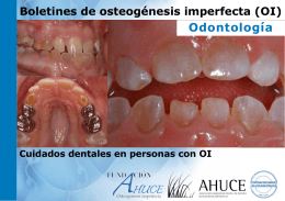 Cuidados dentales en personas con OI