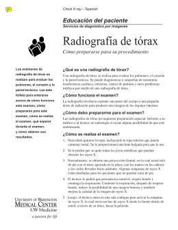 Radiografía de tórax - UWMC Health On-Line