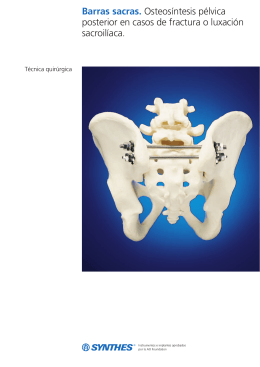 Barras sacras. Osteosíntesis pélvica posterior en casos de fractura o