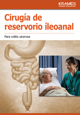Cirugía de reservorio íleoanal