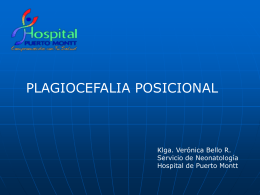 Plagiocefalia Posicional