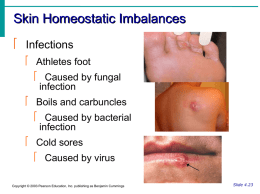 Skin Homeostatic Imbalances