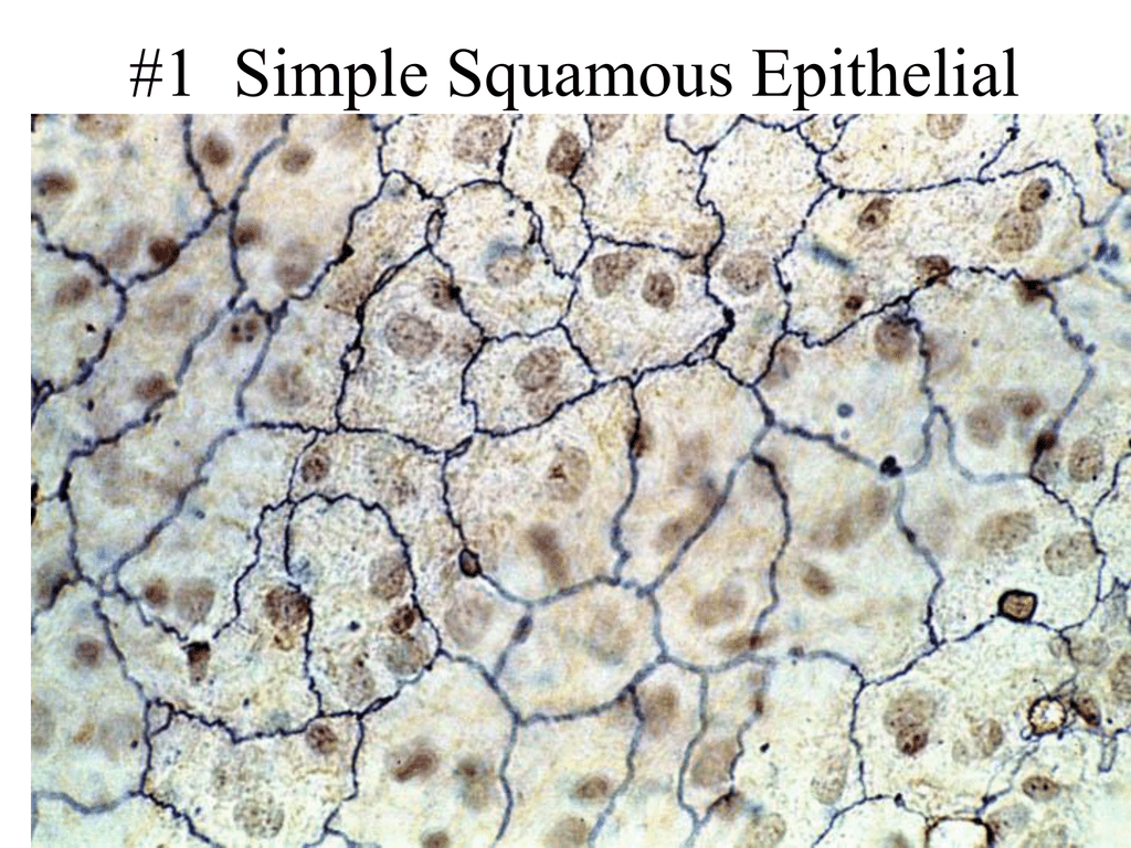 Микропрепараты тканей. Однослойный плоский эпителий микроскоп. Однослойный плоский эпителий мезотелий микроскоп. Однослойный плоский эпителий гистология. Однослойный плоский эпителий микропрепарат.