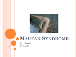 Marfan-Syndrome