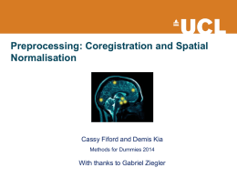 Preprocessing: coregistration and spatial normalization