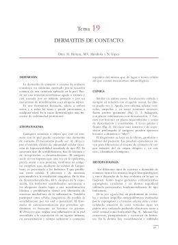 Tema 19 DERMATITIS DE CONTACTO