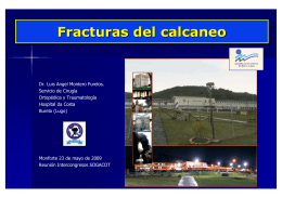 Fracturas calcaneo. Dr. Montero 2009