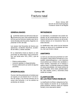 Fractura nasal